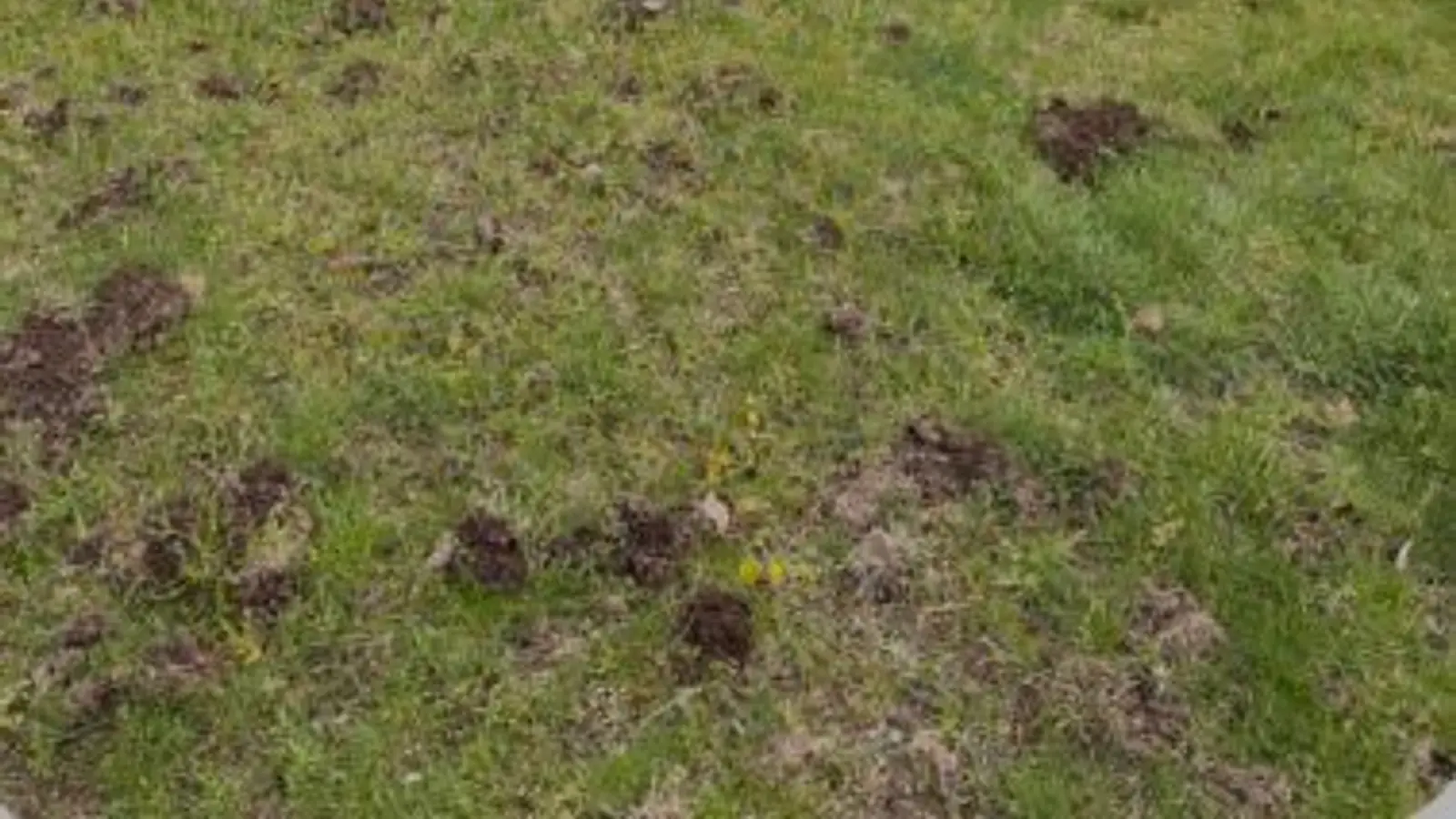 Professional Mole Removal in Western Washington